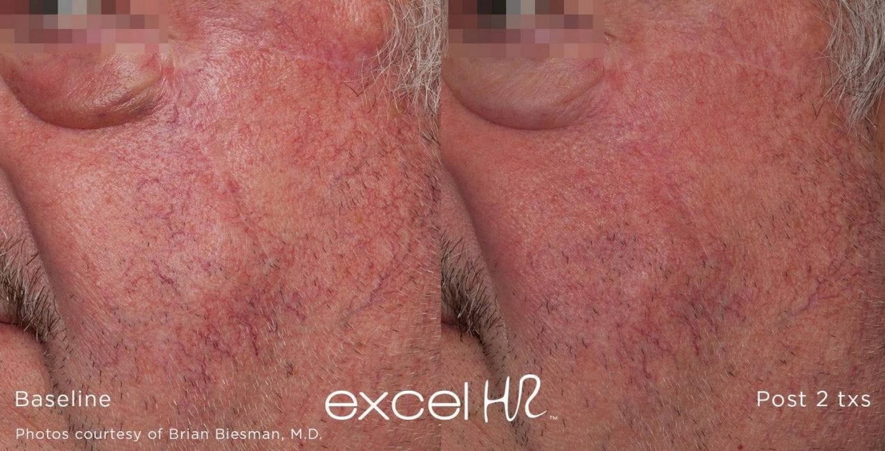 Excel HR Acadiana Women's Health Group